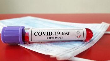 Firmalar için Covid 19 Antikor Testi çalışmalarımız Başlamıştır.